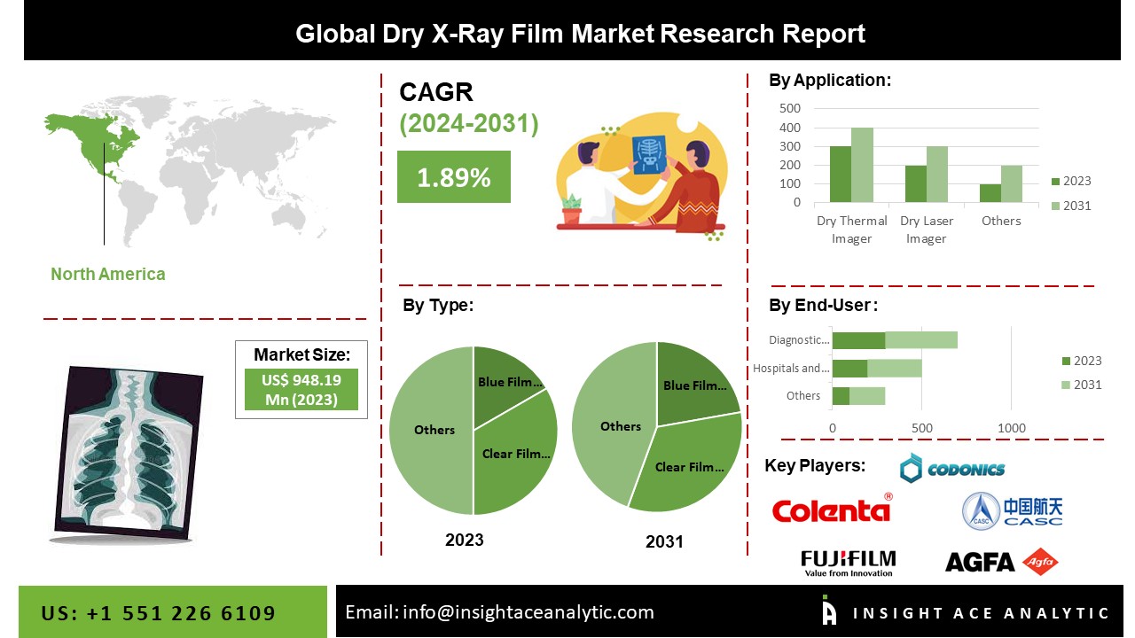 Dry X-Ray Film Market