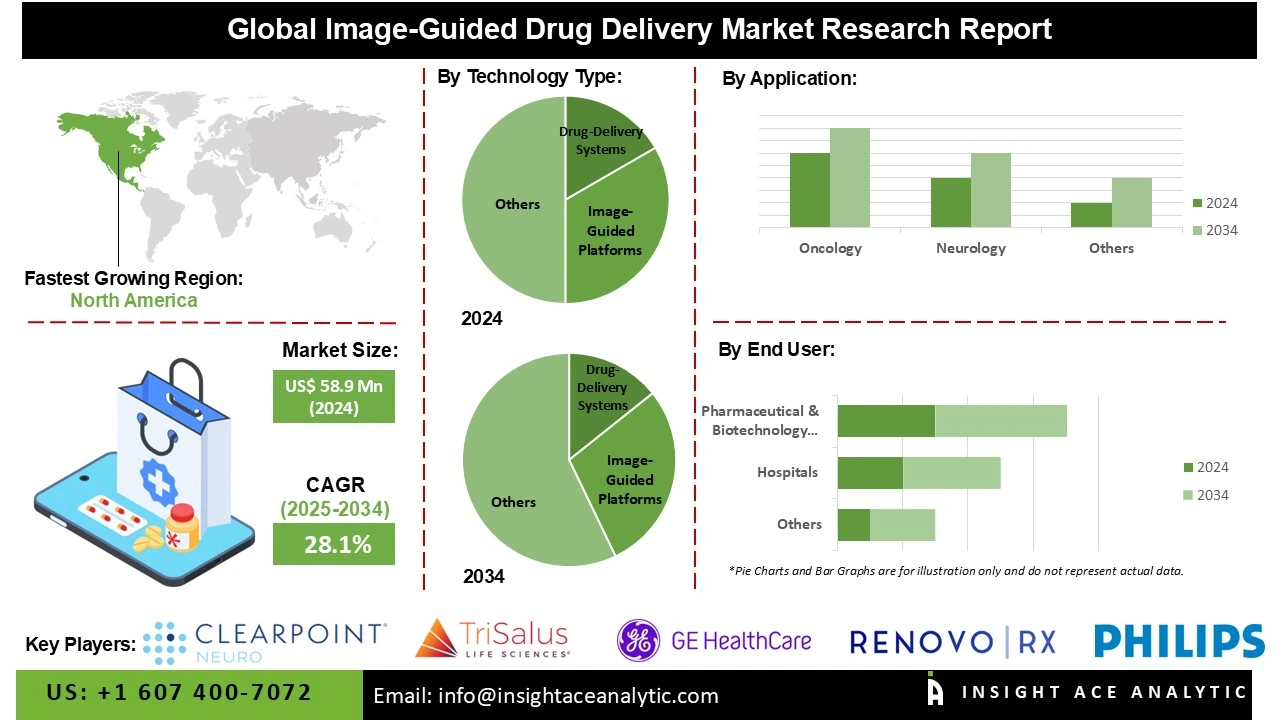 Image-Guided Drug Delivery Market info